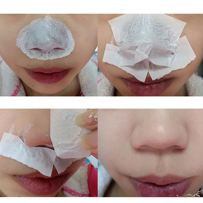 Crème anti- points noirs pour le visage