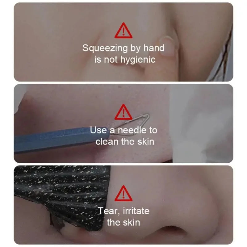 Masque Crème Nez Anti- Points Noirs : Nettoyage Profond des Pores et Réduction des Imperfections