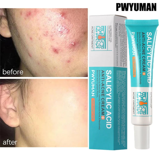 Crème Anti-Acné à l'Acide Salicylique Réparation Anti-Acné Rougeurs Boutons Nettoyage Profond des Pores Contrôle du Sébum Hydratation Soin de la Peau